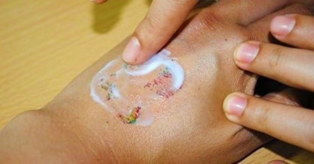 tattoo removal creams that really work